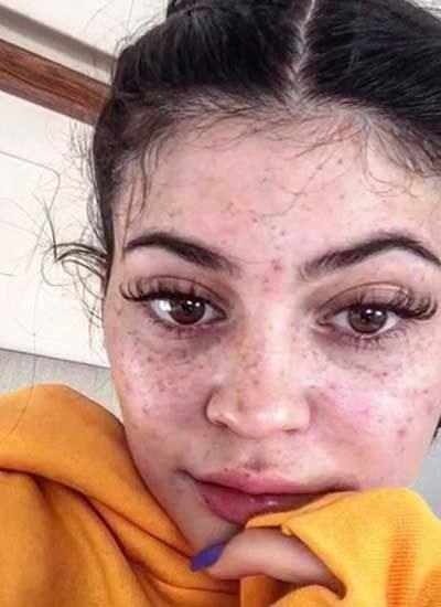 Kylie Jenner no makeup photo