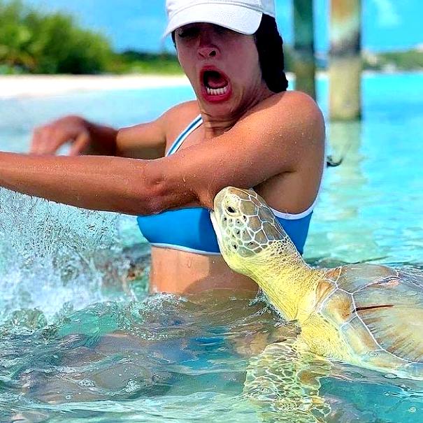 Turtle bites girl